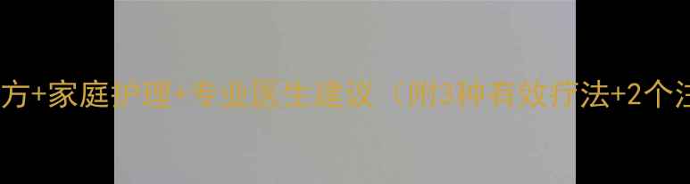图片 手癣民间偏方+家庭护理+专业医生建议（附3种有效疗法+2个注意事项）1