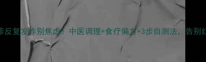 荨麻疹反复发作别焦虑中医调理食疗偏方3步自测法告别红疹瘙痒